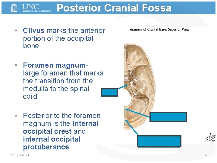 Posterior Cranial Fossa • Clivus marks the anterior portion of the occipital bone •