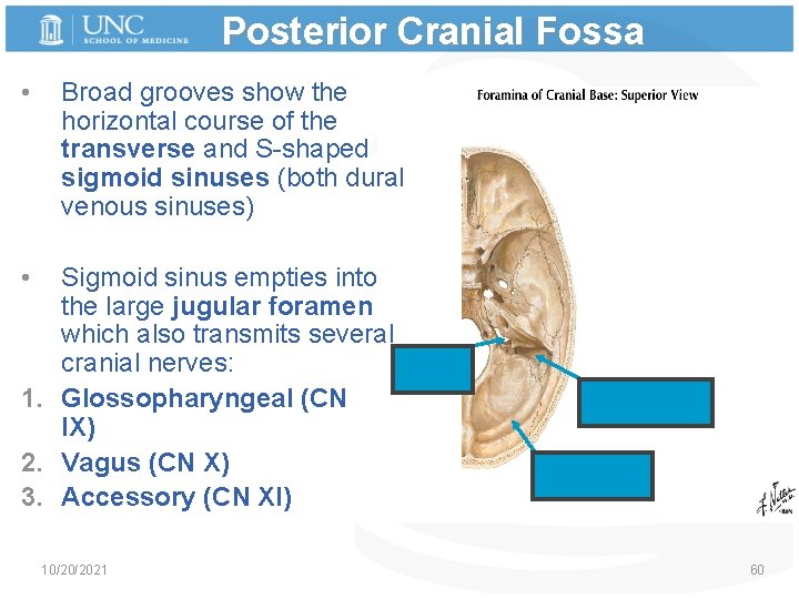 Posterior Cranial Fossa • Broad grooves show the horizontal course of the transverse and