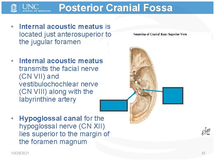 Posterior Cranial Fossa • Internal acoustic meatus is located just anterosuperior to the jugular