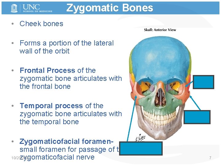 Zygomatic Bones • Cheek bones • Forms a portion of the lateral wall of