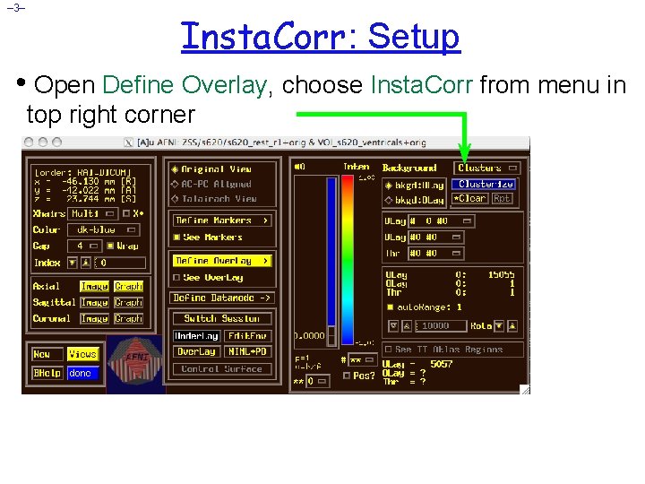 – 3– Insta. Corr: Setup • Open Define Overlay, choose Insta. Corr from menu