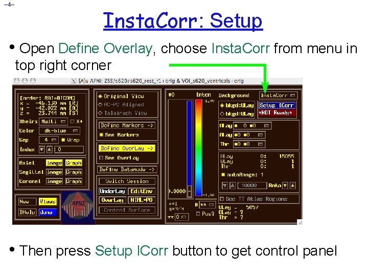 – 4– Insta. Corr: Setup • Open Define Overlay, choose Insta. Corr from menu