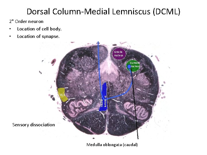 Dorsal Column-Medial Lemniscus (DCML) 2° Order neuron • Location of cell body. • Location