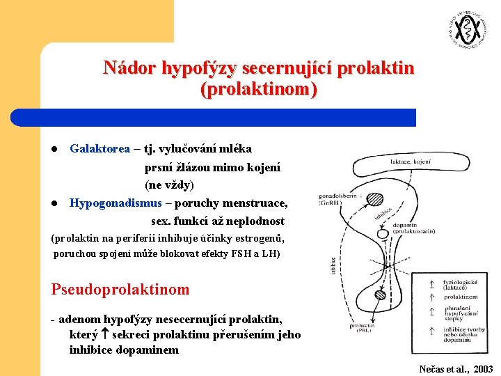 Nádor hypofýzy secernující prolaktin (prolaktinom) l l Galaktorea – tj. vylučování mléka prsní žlázou