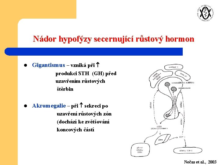 Nádor hypofýzy secernující růstový hormon l Gigantismus – vzniká při produkci STH (GH) před