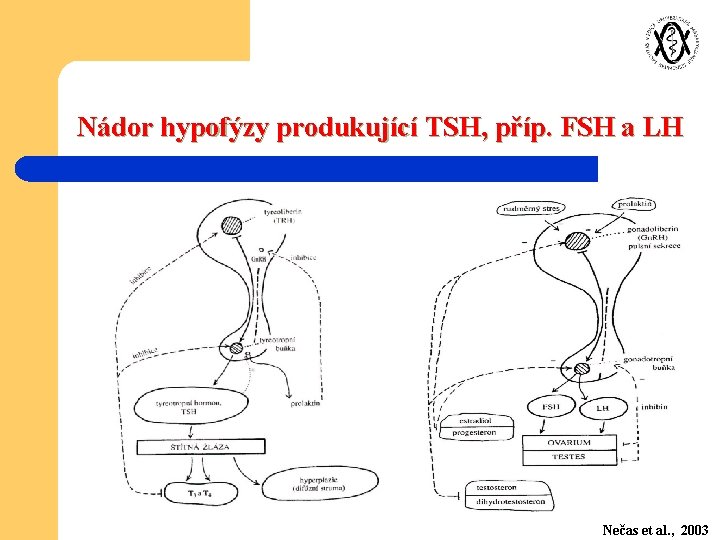 Nádor hypofýzy produkující TSH, příp. FSH a LH Nečas et al. , 2003 