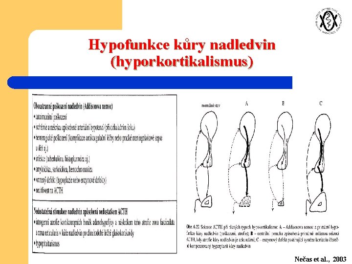 Hypofunkce kůry nadledvin (hyporkortikalismus) Nečas et al. , 2003 