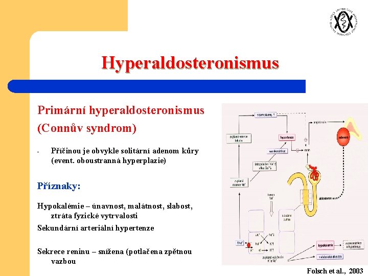 Hyperaldosteronismus Primární hyperaldosteronismus (Connův syndrom) - Příčinou je obvykle solitární adenom kůry (event. oboustranná