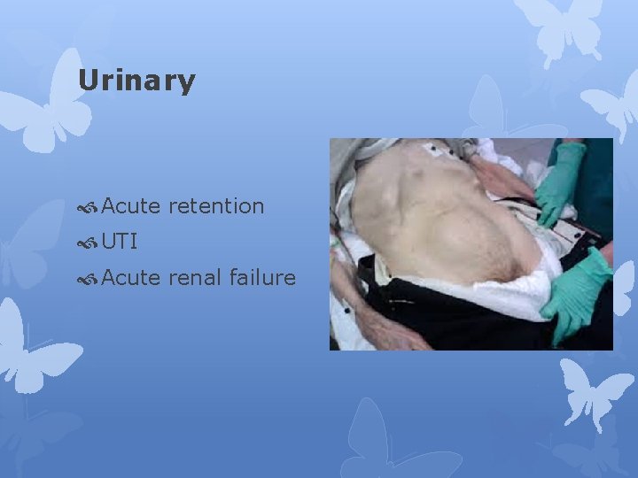 Urinary Acute retention UTI Acute renal failure 