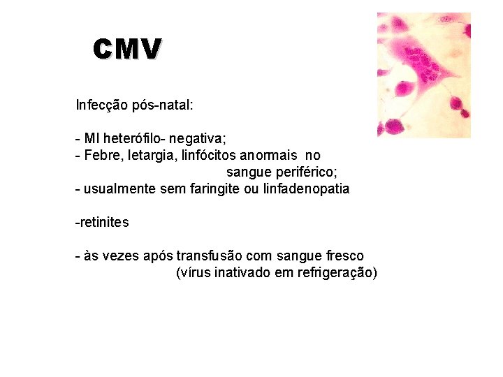 CMV Infecção pós-natal: - MI heterófilo- negativa; - Febre, letargia, linfócitos anormais no sangue CMV Infecção pós-natal: - MI heterófilo- negativa; - Febre, letargia, linfócitos anormais no sangue