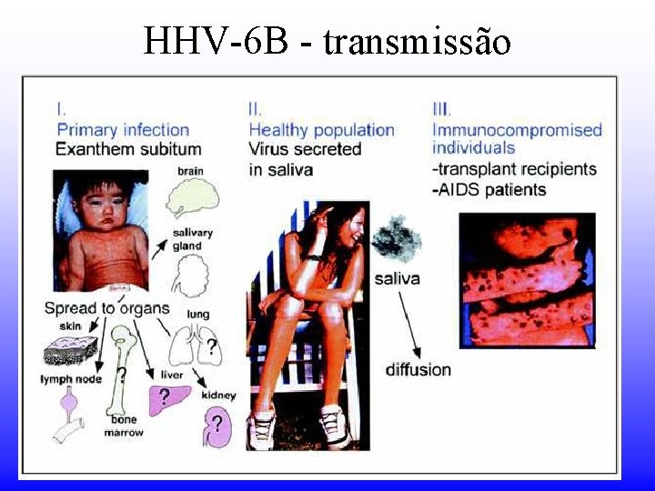 HHV-6 B - transmissão HHV-6 B - transmissão