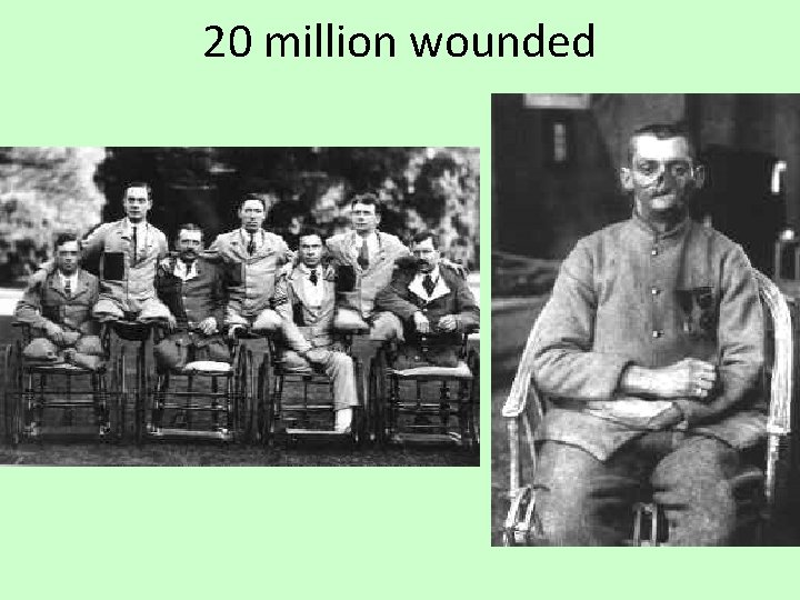 20 million wounded 