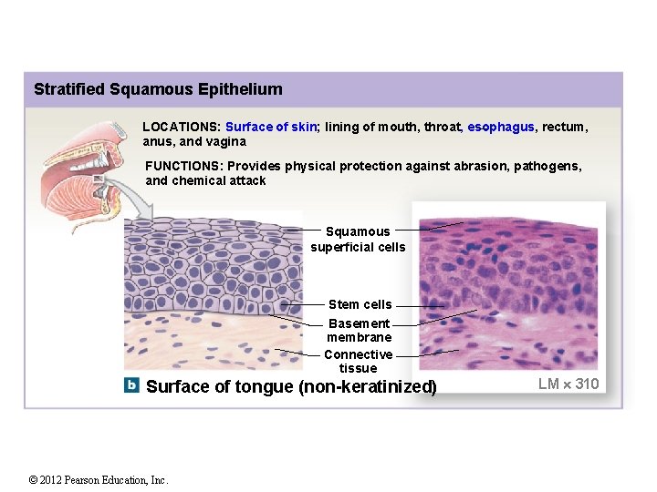 Stratified Squamous Epithelium LOCATIONS: Surface of skin; lining of mouth, throat, esophagus, rectum, anus,