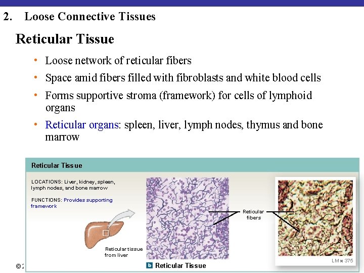 2. Loose Connective Tissues Reticular Tissue • Loose network of reticular fibers • Space