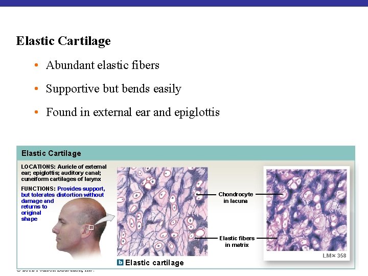 Elastic Cartilage • Abundant elastic fibers • Supportive but bends easily • Found in