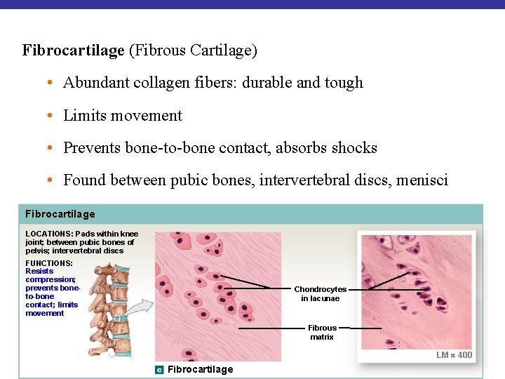 Fibrocartilage (Fibrous Cartilage) • Abundant collagen fibers: durable and tough • Limits movement •