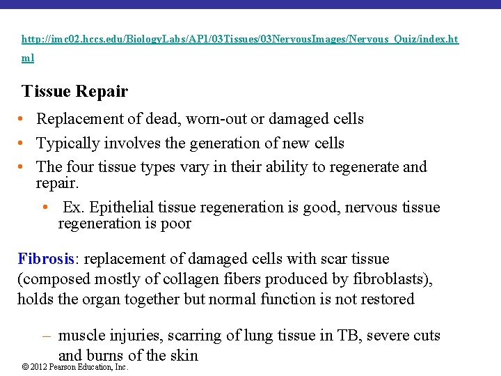 http: //imc 02. hccs. edu/Biology. Labs/AP 1/03 Tissues/03 Nervous. Images/Nervous_Quiz/index. ht ml Tissue Repair