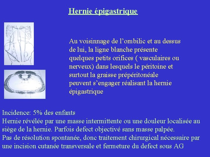 Hernie épigastrique Au voisinnage de l’ombilic et au dessus de lui, la ligne blanche