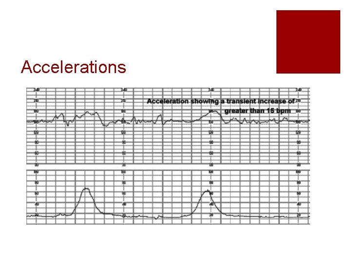 Accelerations Accelerations