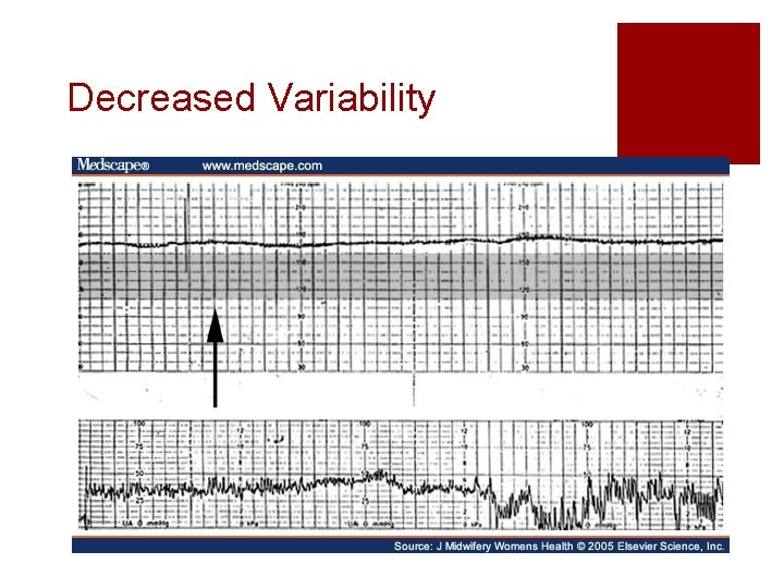 Decreased Variability Decreased Variability