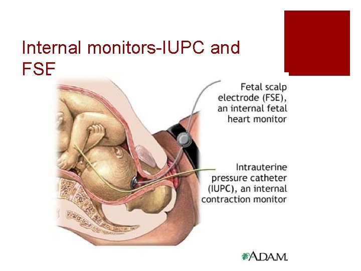 Internal monitors-IUPC and FSE Internal monitors-IUPC and FSE
