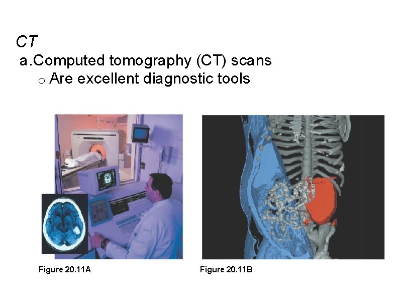 CT a. Computed tomography (CT) scans o Are excellent diagnostic tools Figure 20. 11