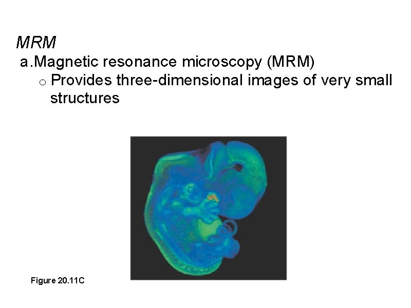 MRM a. Magnetic resonance microscopy (MRM) o Provides three-dimensional images of very small structures