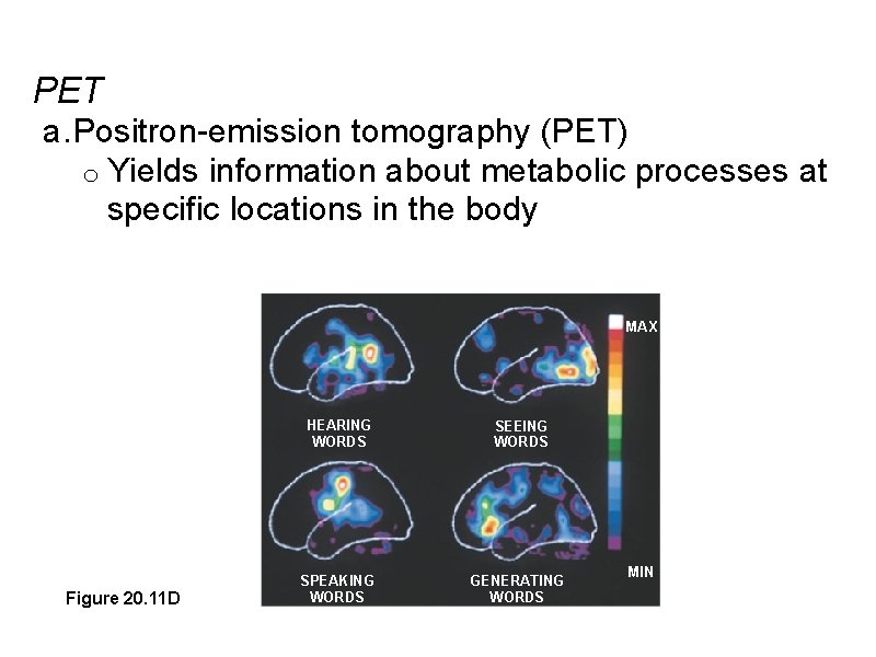 PET a. Positron-emission tomography (PET) o Yields information about metabolic processes at specific locations