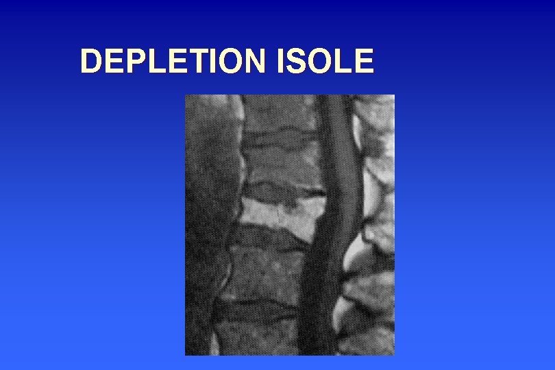 DEPLETION ISOLE 