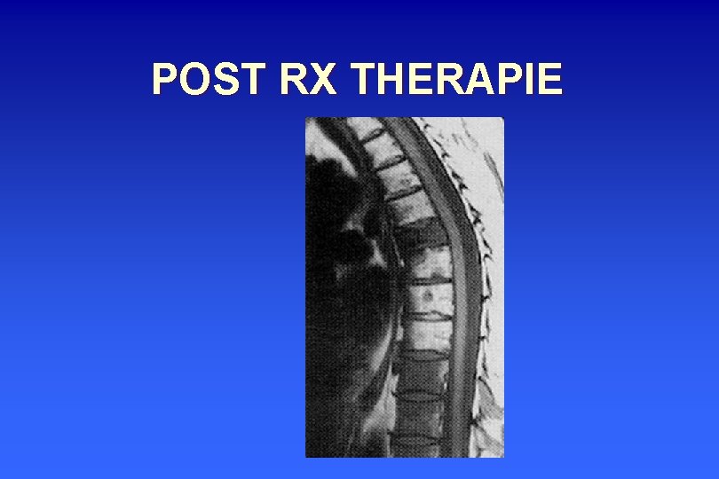 POST RX THERAPIE 