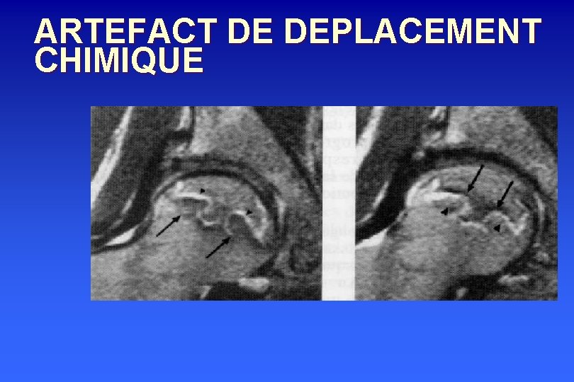 ARTEFACT DE DEPLACEMENT CHIMIQUE 