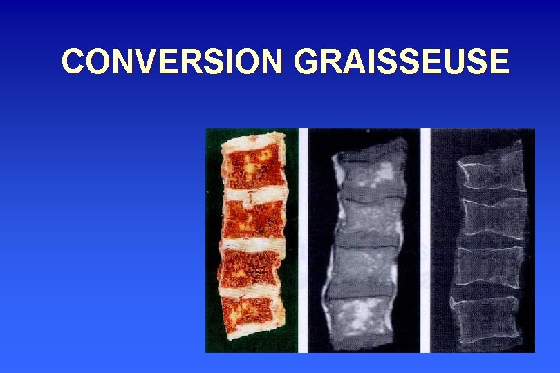 CONVERSION GRAISSEUSE 