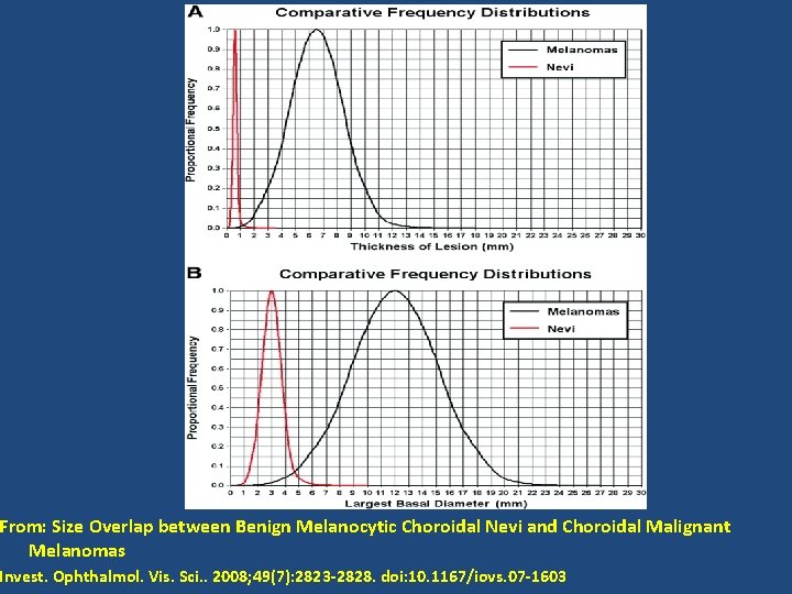 From: Size Overlap between Benign Melanocytic Choroidal Nevi and Choroidal Malignant Melanomas Invest. Ophthalmol.