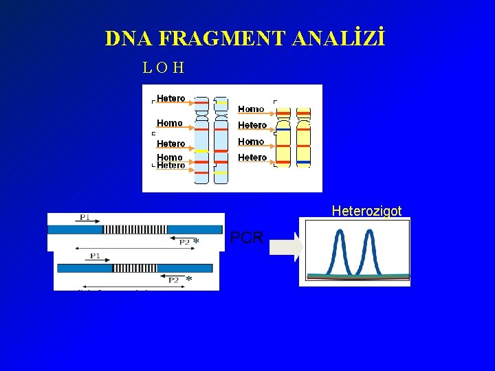 DNA FRAGMENT ANALİZİ LOH Heterozigot PCR 