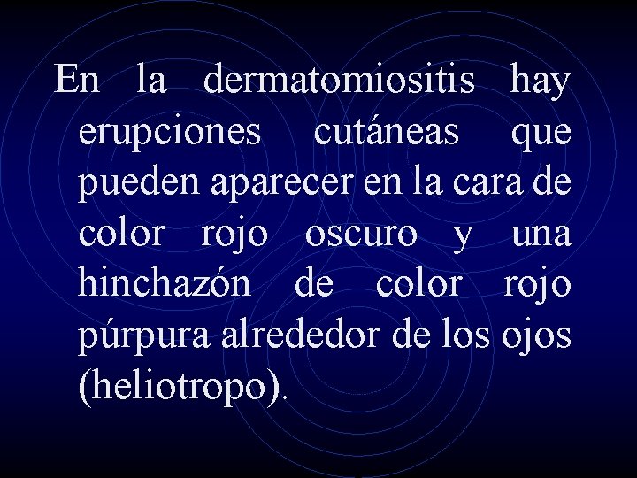 En la dermatomiositis hay erupciones cutáneas que pueden aparecer en la cara de color