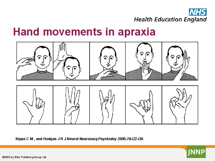 Hand movements in apraxia Kipps C M , and Hodges J R J Neurol