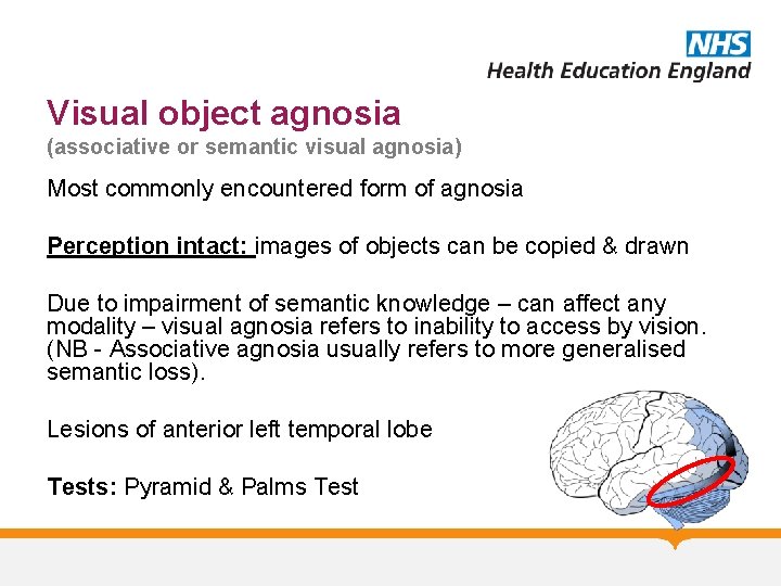 Visual object agnosia (associative or semantic visual agnosia) Most commonly encountered form of agnosia