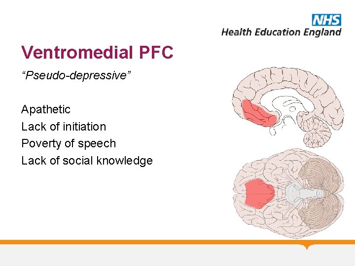 Ventromedial PFC “Pseudo-depressive” Apathetic Lack of initiation Poverty of speech Lack of social knowledge