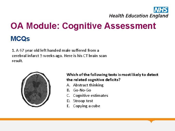 OA Module: Cognitive Assessment MCQs 1. A 67 year old left handed male suffered