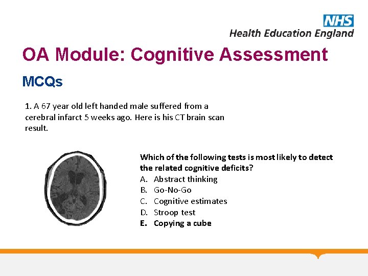 OA Module: Cognitive Assessment MCQs 1. A 67 year old left handed male suffered