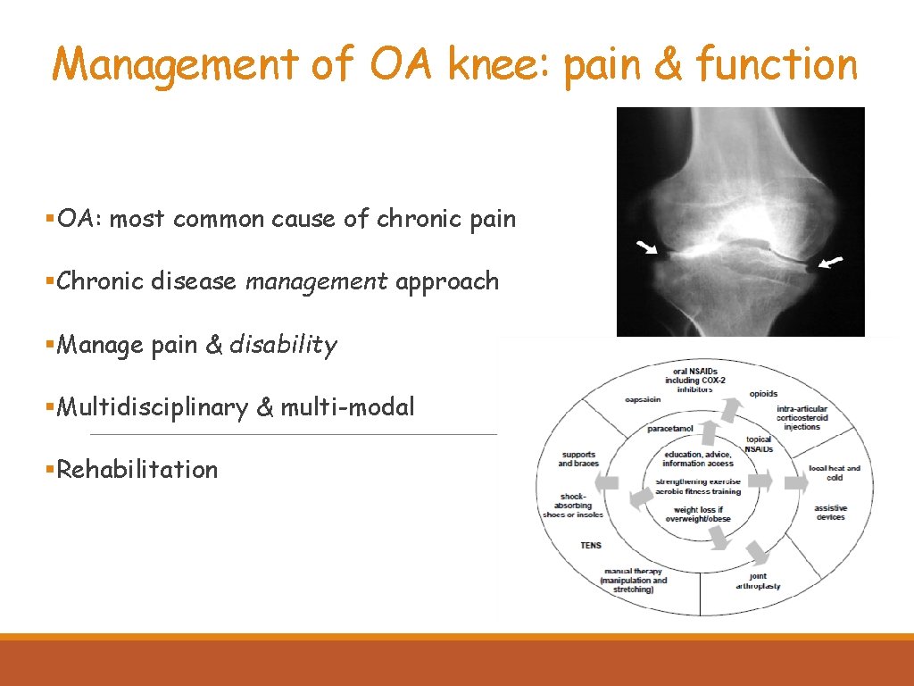 Management of OA knee: pain & function §OA: most common cause of chronic pain