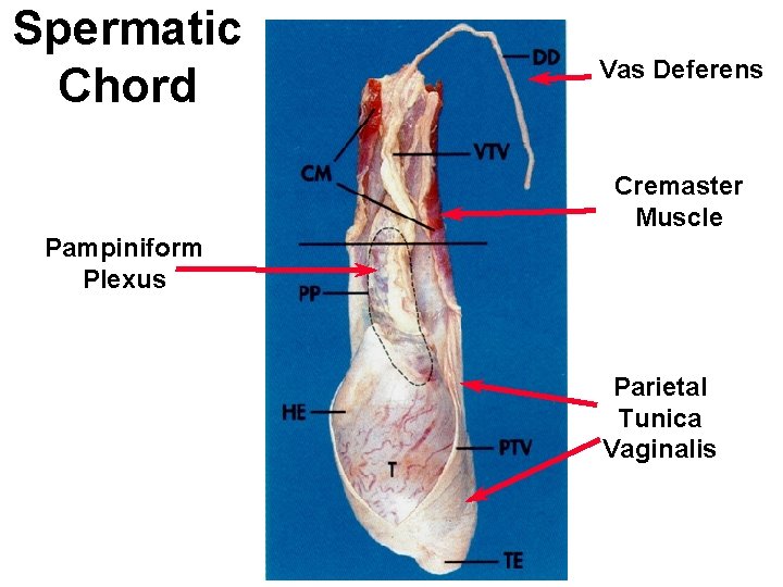 Spermatic Chord Vas Deferens Cremaster Muscle Pampiniform Plexus Parietal Tunica Vaginalis 