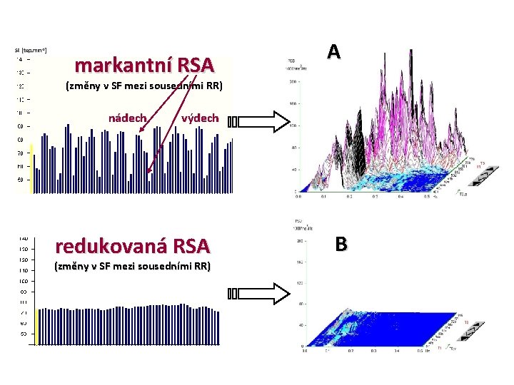 SF [tep. min-1] markantní RSA A (změny v SF mezi sousedními RR) nádech výdech