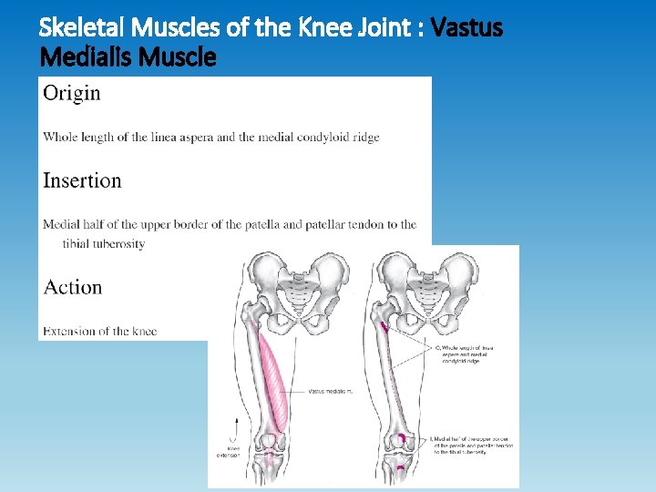 Skeletal Muscles of the Knee Joint : Vastus Medialis Muscle Skeletal Muscles of the Knee Joint : Vastus Medialis Muscle
