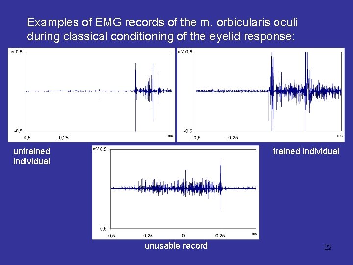 Examples of EMG records of the m. orbicularis oculi during classical conditioning of the