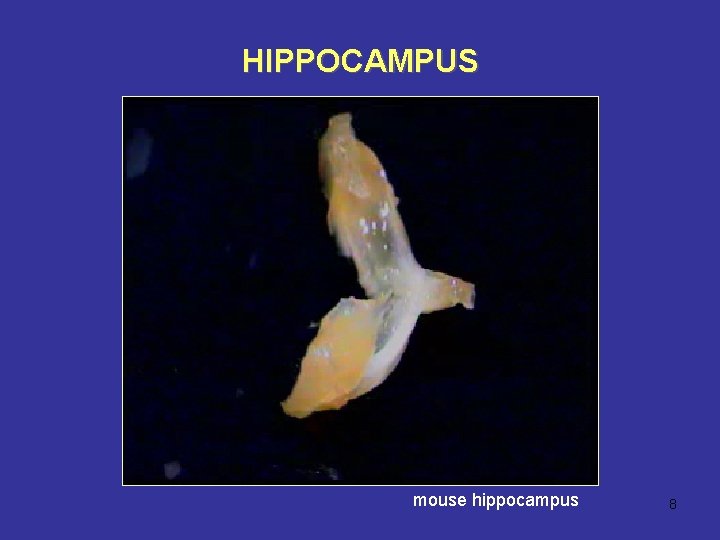 HIPPOCAMPUS mouse hippocampus 8 