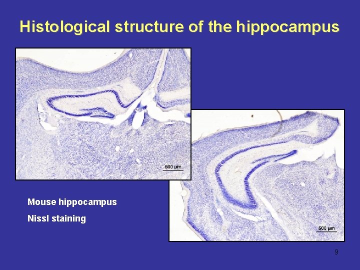 Histological structure of the hippocampus Mouse hippocampus Nissl staining 9 