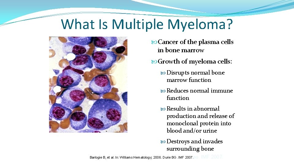 What Is Multiple Myeloma? Cancer of the plasma cells in bone marrow Growth of