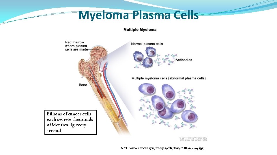 Myeloma Plasma Cells Billions of cancer cells each secrete thousands of identical Ig every