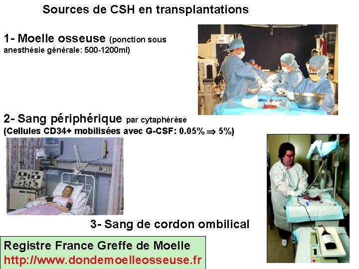 Sources de CSH en transplantations 1 - Moelle osseuse (ponction sous anesthésie générale: 500